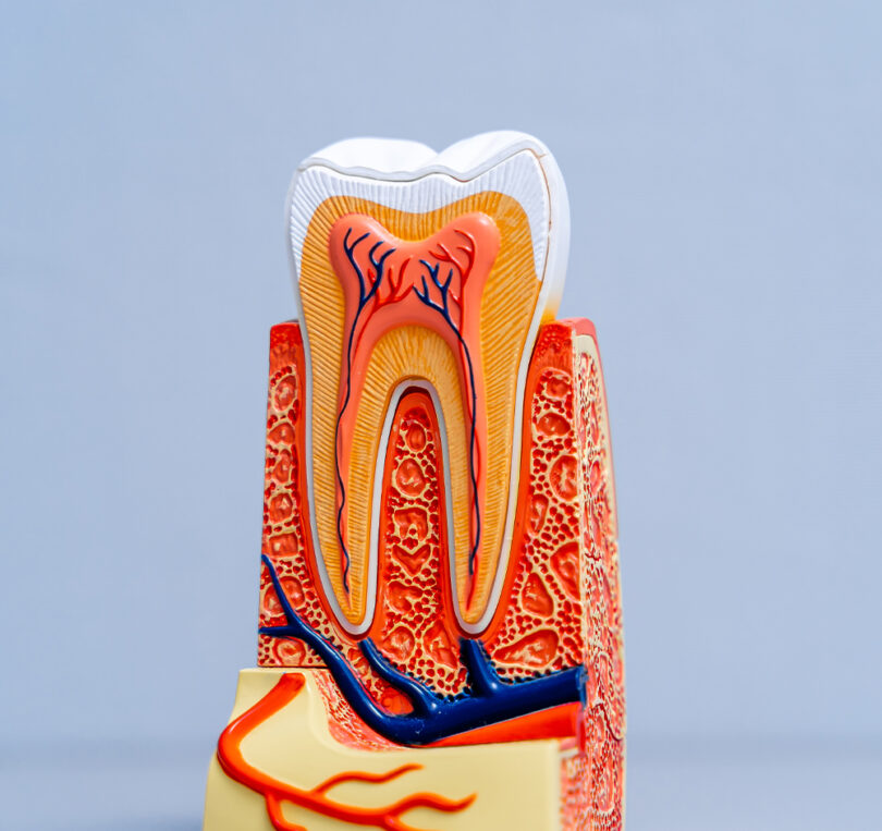 blog - Briars Dental