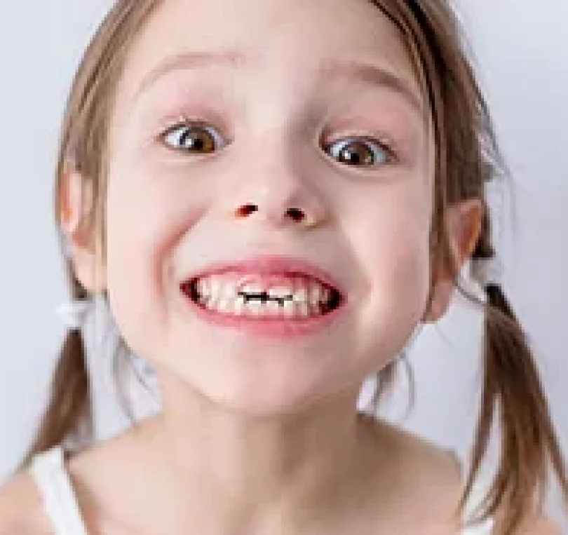 blog - Briars Dental