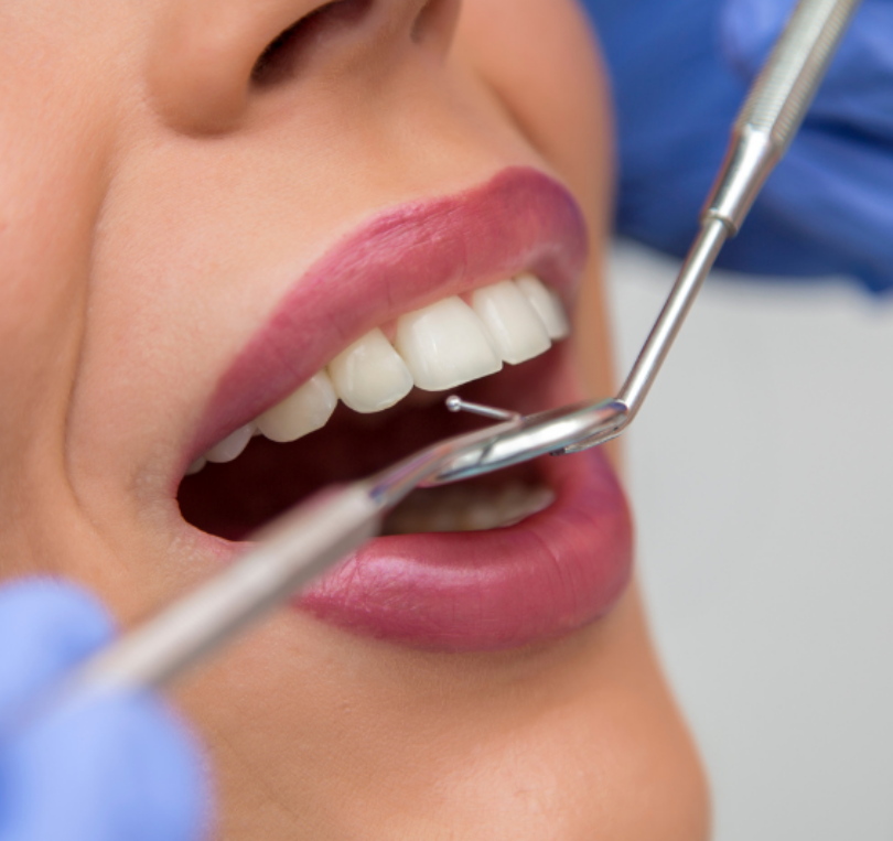 direct access hygienist